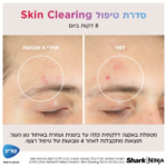 אביזרי טיפוח SHARK שארק FW312EU