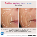 אביזרי טיפוח SHARK שארק FW312EU